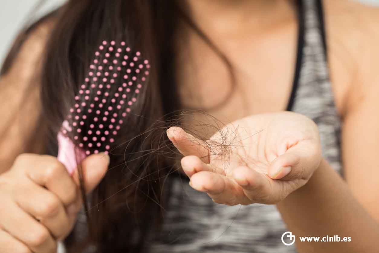 ¿Cuales son las causas de la caída de cabello?
