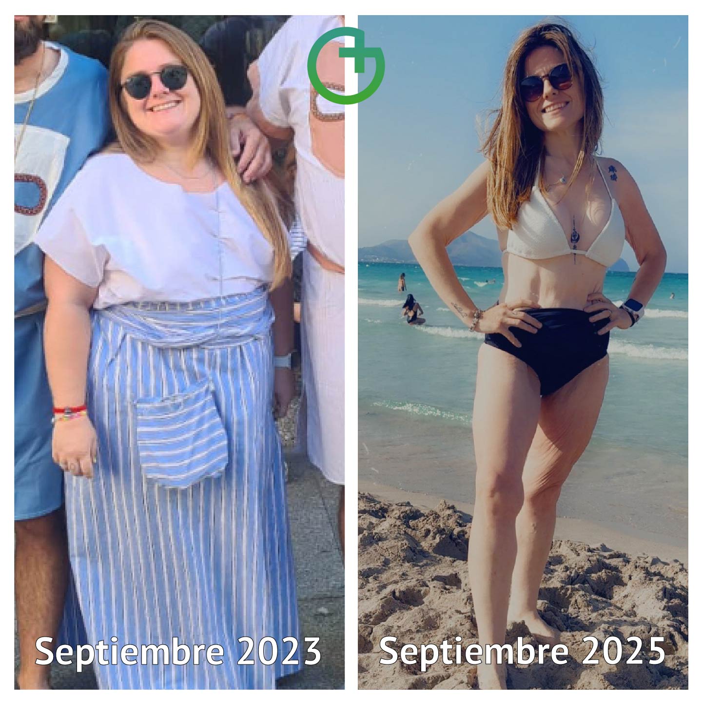 testimonio martina ruiz operacion obesidad